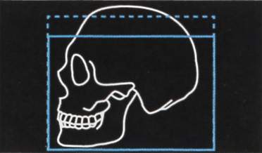 TAC Dental I-Max Ceph 3D - Vista lateral cráneo completo