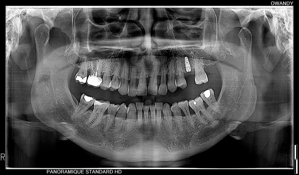 Panorámica dental