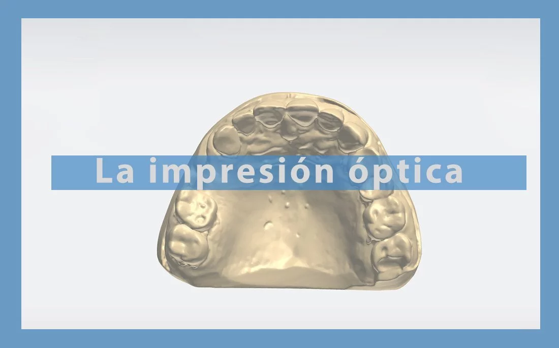 Vig-Optical-print2.jpg-2