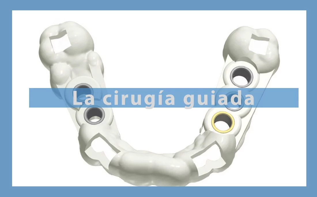 Vig-cirugia-guiada.jpg
