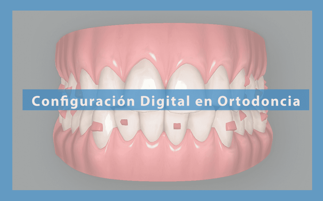 La Configuración Digital en Ortodoncia